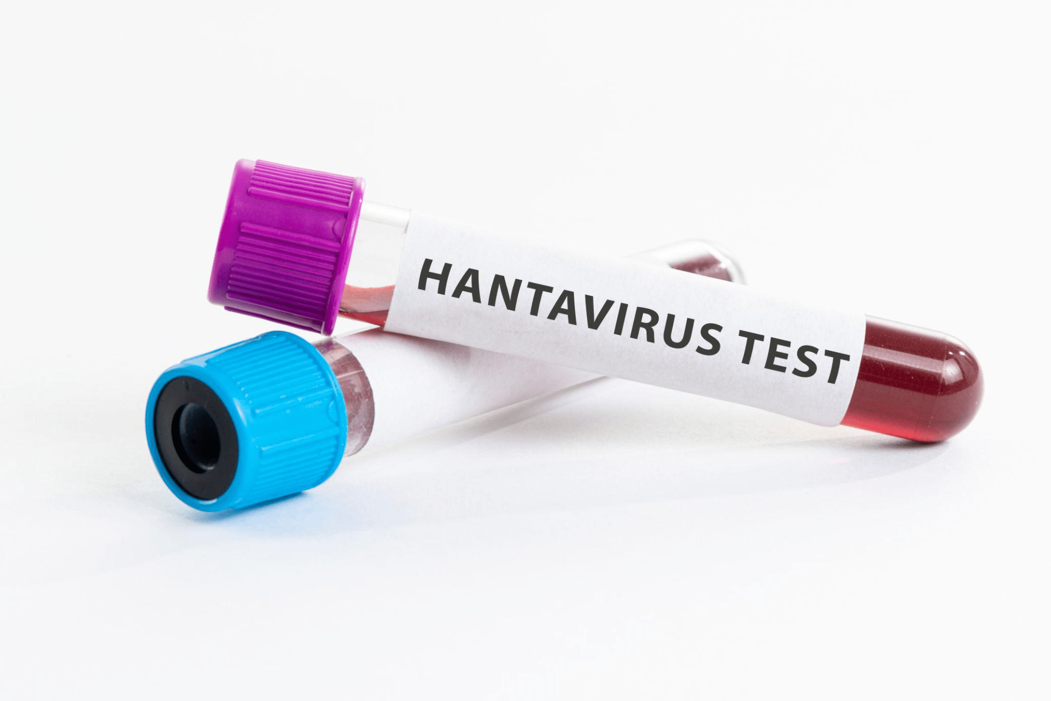 Waspada Hantavirus, 23 Kasus Sudah di Indonesia dan CFR-nya Capai 38 Persen
