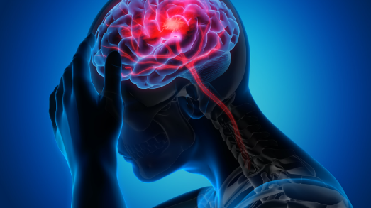 Cara Cegah Stroke Sejak Dini, Jangan Tunggu Usia Tua untuk Mulai Hidup Sehat 2 Stroke